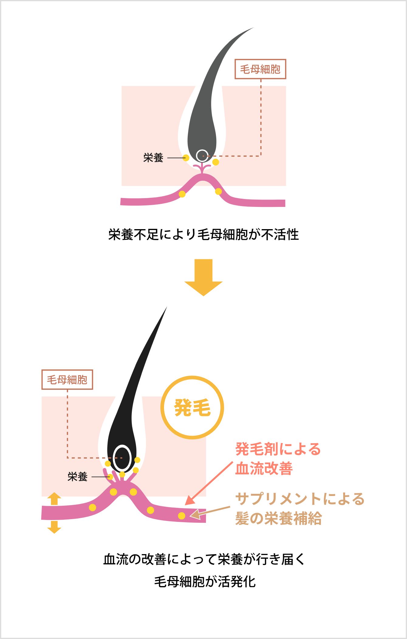 栄養不足により毛母細胞が不活性 → 血流の改善によって栄養が行き届く 毛母細胞が活性化